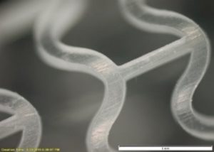 Femtosecond laser cutting of PLLA biodegradable stent